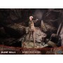 Фігурка Пузиреголова медсестра First 4 Figures з гри Silent Hill 2